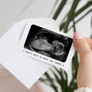 Personalised Baby Scan Photo Metal White Wallet Card